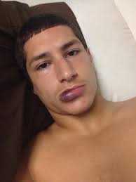 We did not find results for: Vinny Sherry On Twitter The End Result When You Bite Through Your Lip Http T Co G31wktriha