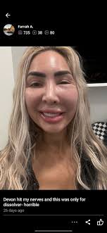 Farrah's latest attempt to change her (ever-changing) face has backfired–  and the fired 'Teen Mom OG' star was back