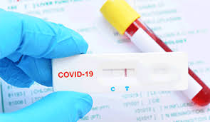 Junit test cases are organize into corona test suites. South Korean Firm S Rapid Covid 19 Test Receives Ce Mark 2020 11 06 Fdanews
