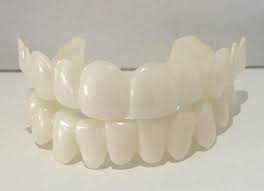 Snap On Smile That You Can Eat With True Smile Snap On Veneers That You Can Eat With In 2020 Snap On Smile Smile Teeth Veneers Teeth