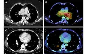 Image result for Incidental Imaging Finding
