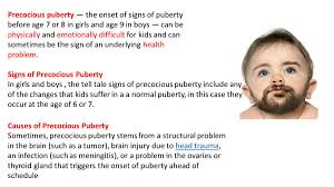 Image result for Precocious Puberty