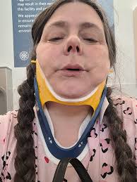 Anyone else run into neck strain ? I get mine healed up and do a workout  and neck hurts all over again i purchased the bobo head strap but im trying  to
