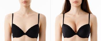 Image result for Breast Augmentation