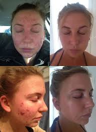 Therapy Kitchen Hclf Vegan Vegan Lifestyle Transformation Body