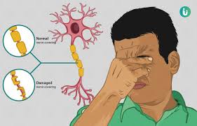 Possible causes of multiple sclerosis researchers have studied a variety of possible causes for multiple sclerosis (ms), and a combination of factors appears to be involved. Multiple Sclerosis Symptoms Causes Treatment Medicine Prevention Diagnosis
