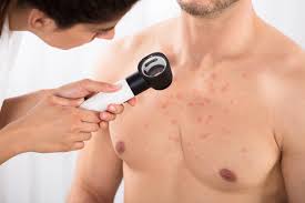 Le coup de soleil est une brûlure plus ou moins grave de la peau survenant après une exposition aux rayons uvb du soleil. Plaques Rouges Un Signe D Allergie Au Chlore