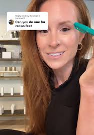 Quick Crows Feet Cosmetic Lesson