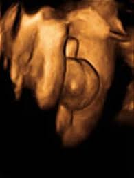 In der schwangerschaft ist die ultraschalluntersuchung des ungeborenen babys für den arzt eines der im verlauf dieser ultraschalls schließen wir auffälligkeiten wie fehlbildungen, mangelzustände o.ä. 3d 4d Ultraschall Ultraschall Untersuchungen Diagnostik Frauenarzte Im Netz Ihr Portal Fur Frauengesundheit Und Frauenheilkunde