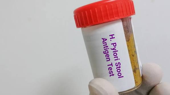 H. Pylori Antigen Stool Test