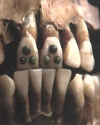 It's well known that the Maya practiced dental modification, but scholars  thought that such procedures were only performed on adults. A new study of  three teeth inlaid with jade, however, determined that
