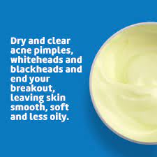 Browse our listings to find jobs in germany for expats, including jobs for english speakers or those in your native language. De La Cruz Sulfur Acne Treatment Maximum Strength And Water Washable To Clear Face And Body Acne For Adults And Teens 2 6 Oz Buy Online In Germany At Desertcart De 1246392