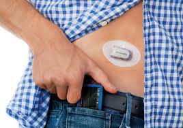 (redirecționat de la pompă cu insulină). Senzor De Glicemie Dexcom G4 In Romania Cat CostÄ Èi Cum Se FoloseÈte Ehealth Romania