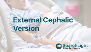 Image result for External Cephalic Version