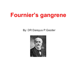 26, born 22 september 1994. Fournier S Gangrene Surgery