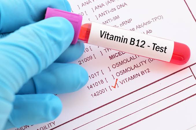 How does Vitamin B12 deficiency get diagnosed?