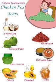 Pin On Home Remedies