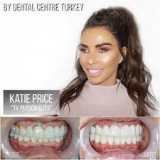 Katie designs smiles that match who you are as a person and your vision for what is attractive. Katie Price Visited Dental Centre Turkey Dental Turkey Smile Dental