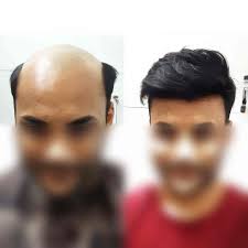 Top Women Beauty Parlours in Pipla