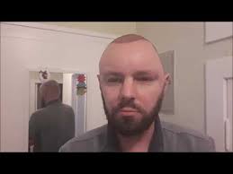 We did not find results for: Haartransplantation Hairmedic 4 Verband Ab