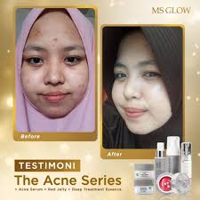Jual paket skincare msglow