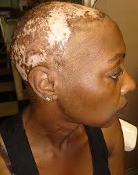 The Sun Natural To Relaxed Hair Natural Hair Styles Hair Relaxers