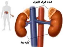 Image result for ‫کمبود انرژی, خستگی زودرس غدد فوق کلیوی‬‎