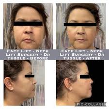 Sandia Oral Surgery and Dental Implants, 7009 Montgomery Blvd NE,  Albuquerque, NM 87109, US