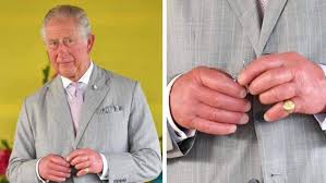 Last month, prince charles took a break from reading goethe to his organic highland sheep (i'm guessing) to attend a charles' hands seemed red and swollen when he met geri horner last month. Prince Charles Fingers Absoluteunits