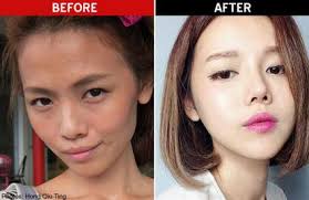 Household cleaning supplies like bleach, dish soap, paper towels, and laundry detergent are about the same price as they were back in the states. Plastic Surgery South Korea Skin Care Talk