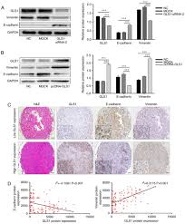 950 din 29.11.2017, a fost publicata hotărârea guvernului româniei nr. Expression Of Gls1 In Intrahepatic Cholangiocarcinoma And Its Clinical Significance