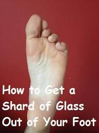 How To Get A Shard Of Glass Out Of Your Foot How To Remove Homemade Foot Soaks Feet Care