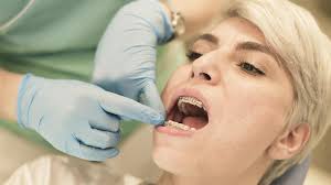 You can earn by taking paid surveys, participate in free contests, and invite friends to join. Why More Adults Are Getting Braces Wsj