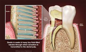 Grand Haven Dentist Tooth Sensitivity Arbutante Dental Dental Tooth Sensitivity Dental Anatomy