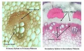 Secondary Xylem And Primary Xylem Similarities And Differences Compare And Contrast Structure And Function