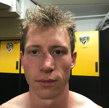 Grimsey nose how tough pre-season can be 😲 Luckily this morning's injury  will snot affect his preparation for the upcoming season. 📰