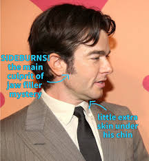 John Mulaney Did NOT Have Cosmetic/ Plastic Surgery!!(Jaw Filler Conspiracy  Destroyed) : r/JohnMulaney