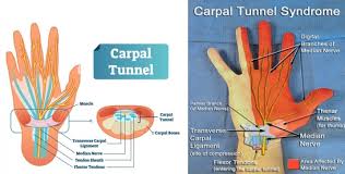 Image result for karp ln  tunel ort za