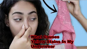 Causes Of Yellow Discharge In Toddler Underwear