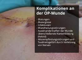 Thrombozytopenie, der mangel an thrombozyten im blut, kann von verschiedenen ursachen herrühren. Wundheilungsstorung Und Komplikationen An Der Wunde