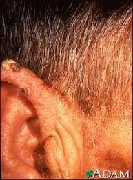 Identify Cancerous Non Cancerous And Pre Cancerous Skin Lesions Skin