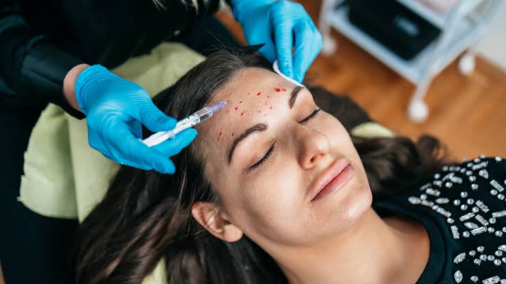 What Is a Vampire Facial? An Esthetician Explains This Skin Care Trend -  GoodRx
