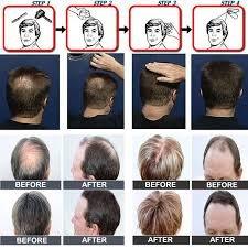 The wave of keratin hair treatments has swept the nation! 25g Hair Fiber Keratin Hair Building Fiber Refill Bag Hair Styling Powder Hair Loss Concealer Blender Salon Beauty Hair Loss Products Aliexpress