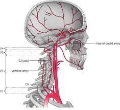 The internal carotid artery (latin: 2 The Course Of The Vertebral And Internal Carotid Arteries Through The Download Scientific Diagram