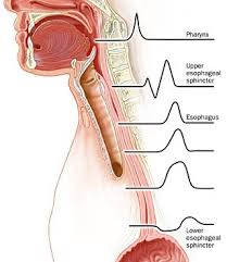 Achalasia A Rare Motor Disorder Of Esophagus Esophageal Spasm Disorders Health