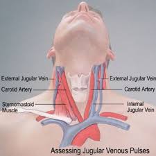 The carotid arteries run along either side of your neck. Closer Than Your Jugular Vein Medical Anatomy Medical Knowledge Cardiac Assessment