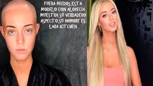 Podcast Belleza desde la Raíz: Entrevistamos a la modelo con alopecia  Jihane 🧑🏼‍🦲✨