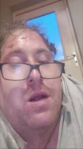 #better #revovery #tonywright #mate