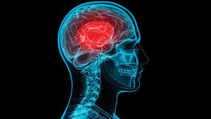 If you suffer concussion after a blow to your head, you lose consciousness or feel sick. When Is Brain Imaging Ct Mri Needed For A Concussion Sportssafe Pediatric Concussion Clinics