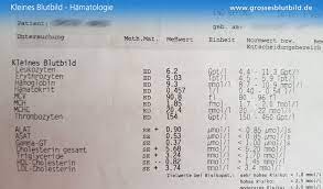 Das große blutbild wird vor allem bei verdacht auf eine akute oder. Grosses Blutbild Alle Werte Des Hamogramm Verstandlich Erklart